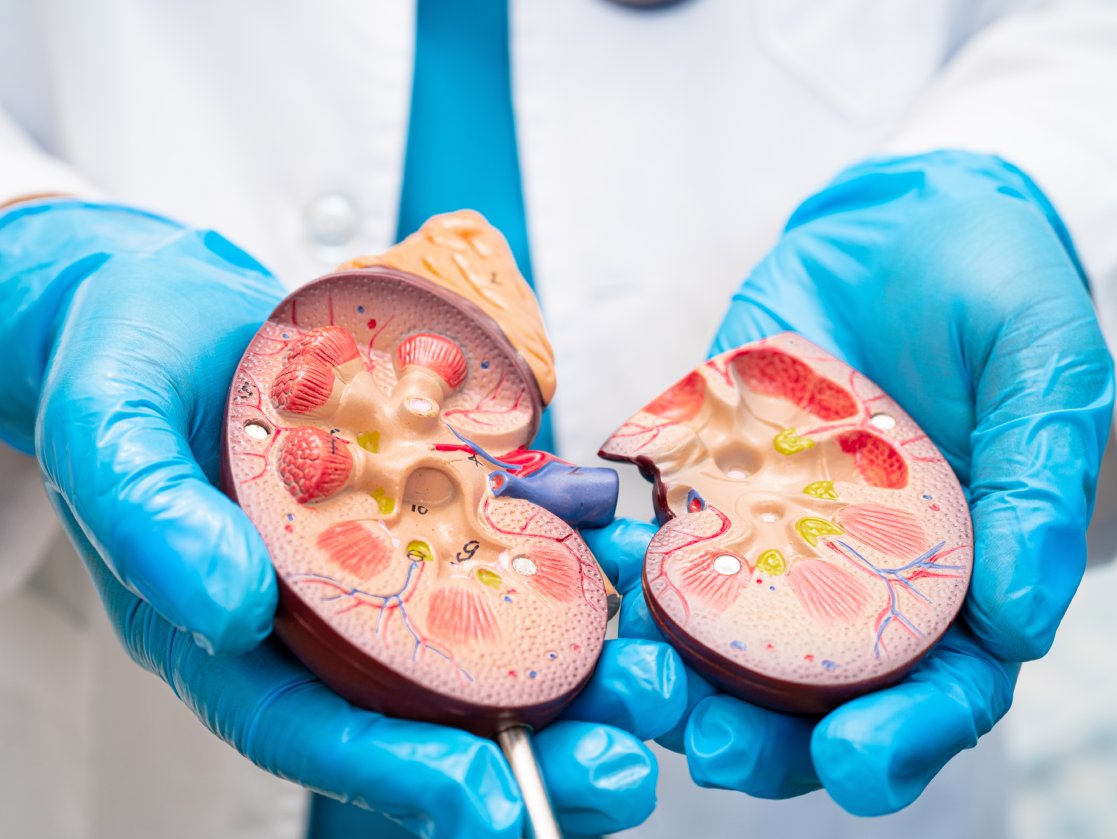 colico renal